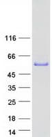 Human CERKL Protein (Recombinant Myc-DDK (Flag))