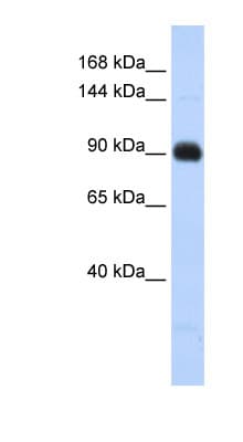 Polyclonal Rabbit anti-Human MATN2 / Matrilin 2 Antibody (aa791-840, WB)