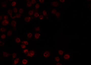 Polyclonal Rabbit anti-Human DKC1 / Dyskerin Antibody (IF, WB)