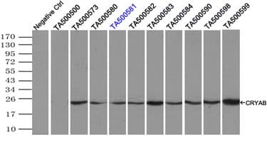 CRYAB / Alpha B Crystallin Antibody (clone OTI6A9)
