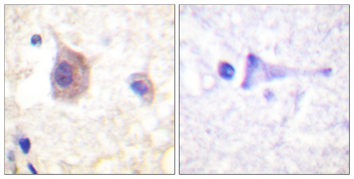 PRKD1 / PKC Mu Antibody (phospho-Tyr463)