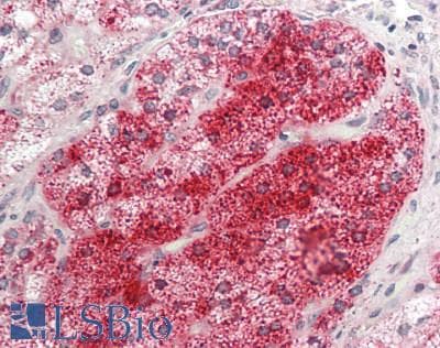 IHC-plus™ Polyclonal Rabbit anti-Human HSPE1 / HSP10 / Chaperonin 10 Antibody (aa38-64, IHC, WB)