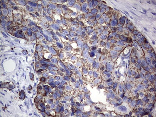 Acidic Cytokeratin Antibody (clone 8A3)