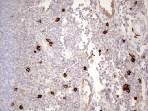 c-Kit / CD117 Antibody (aa27-308, clone OTI1B6)