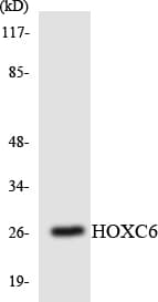 Polyclonal Rabbit anti-Human HOXC6 Antibody (aa171-220, WB)