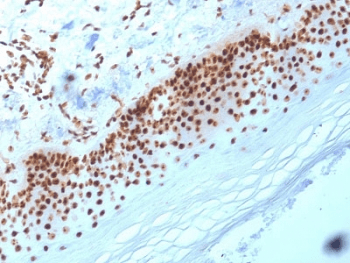 Monoclonal Mouse anti-Human NPM1 / NPM / Nucleophosmin Antibody (clone NA24, IHC)
