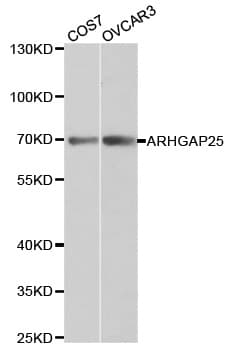 ARHGAP25 Antibody