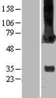 CAMK2G / CaMK II Gamma Protein (Over-Expression Lysate Myc-DDK (Flag))