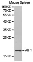 Polyclonal Rabbit anti-Human AIF1 / IBA1 Antibody (IHC, WB)