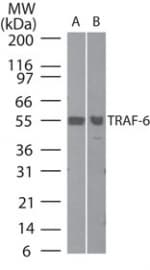 Polyclonal Rabbit anti-Human TRAF6 Antibody (aa436-449, WB)
