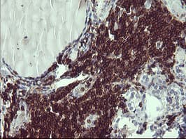 CD45 / LCA Antibody (clone OTI3F2)