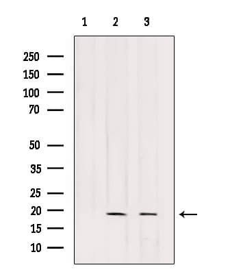 Polyclonal Rabbit anti-Human POLR2G / RPB7 Antibody (WB)