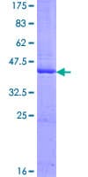 Human FSD1L Protein (Recombinant GST)