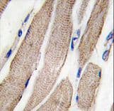 MAP2K5 / MEK5 Antibody (Ser149)