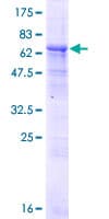 Human DXO / DOM3Z Protein (Recombinant GST)