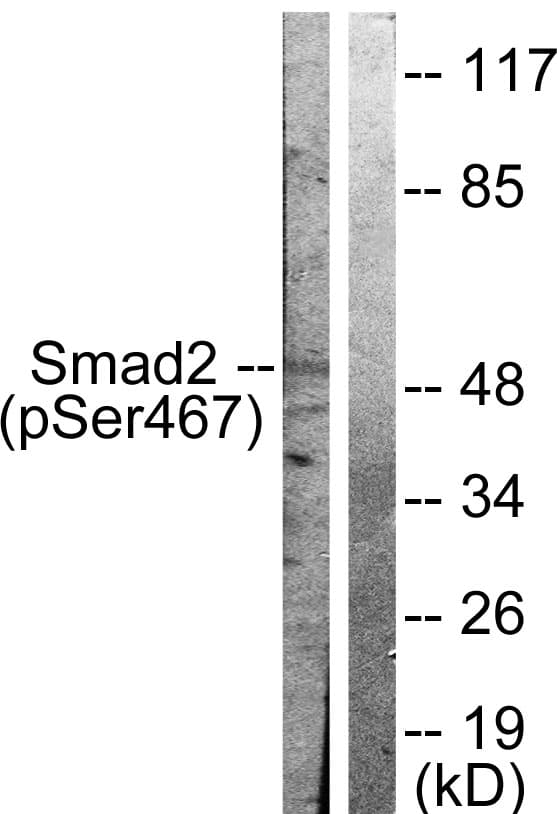 SMAD2 Antibody (phospho-Ser467)