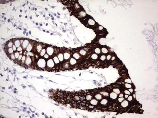 Monoclonal Mouse anti-Human KRT19 / CK19 / Cytokeratin 19 Antibody (clone OTI1F5, aa240-390, IHC, WB)