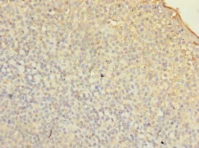 FMNL1 Antibody