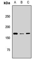 BAZ1B / WSTF Antibody