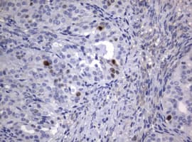 Monoclonal Rat anti-Human MKI67 / Ki67 Antibody (clone OTI9C3, IHC, WB)