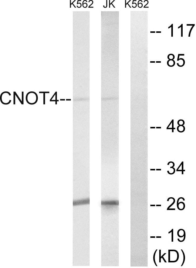 CNOT4 / CLONE243 Antibody