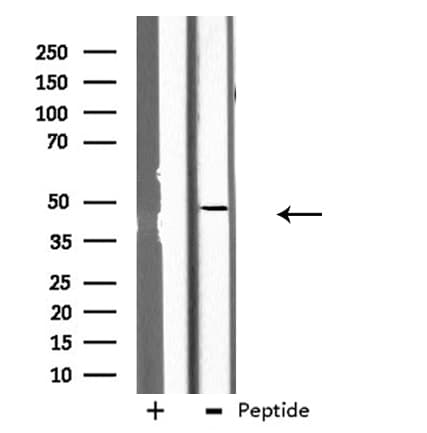 Polyclonal Rabbit anti-Human GCNT7 Antibody (IHC, IF, WB)