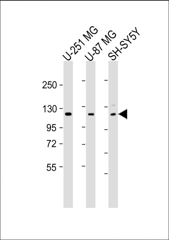 SH3PXD2B Antibody (C-Terminus)