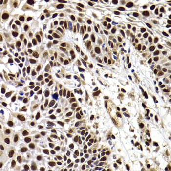 Polyclonal Rabbit anti-Human HIRIP3 Antibody (IHC, IF, WB)