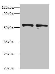 Polyclonal Rabbit anti-Human SPTLC1 / HSN1 Antibody (aa37-310, IHC, WB)