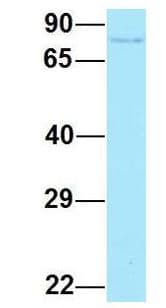 ARHGAP22 / RhoGAP2 Antibody (aa573-622)