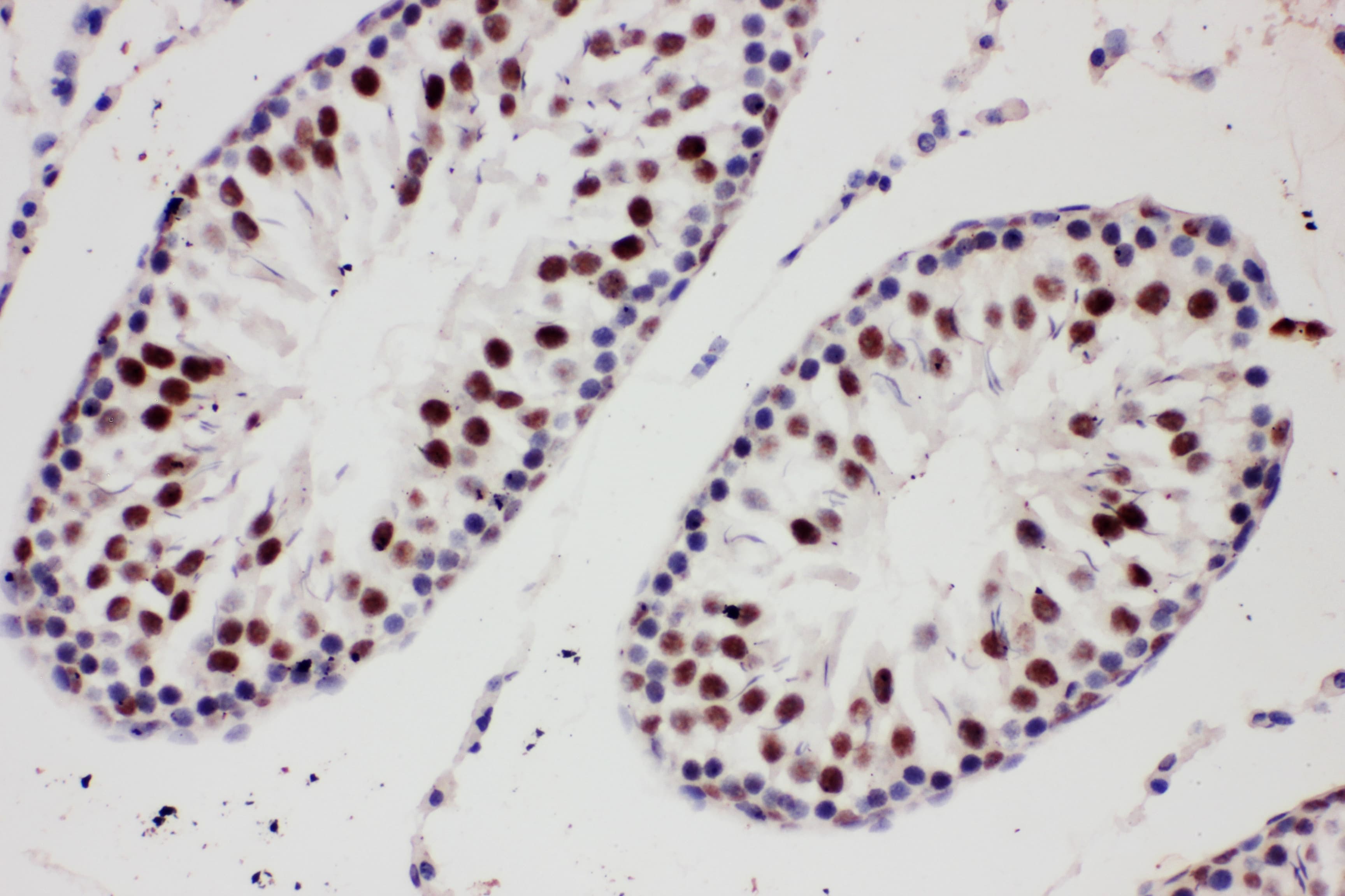 PIAS1 Antibody (aa636-651)