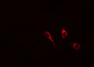 PRKD1 / PKC Mu Antibody (phospho-Tyr463)