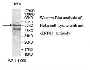 ZNF83 / HPF1 Antibody (aa56-332)
