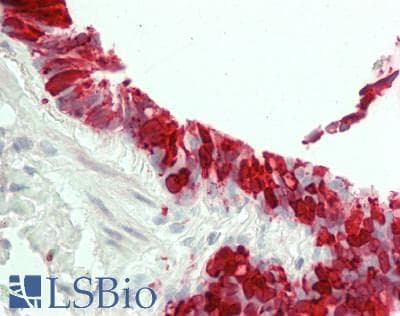 ALOX15 / 15-Lipoxygenase Antibody (clone 7H6, Carrier-free)