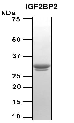 Human IGF2BP2 Protein (Recombinant 6His, N-terminus)