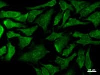 EMC8 / COX4NB Antibody (clone 2643C6a)