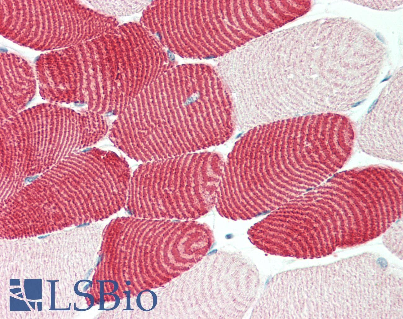 IHC-plus™ Polyclonal Rabbit anti-Human MYH7 Antibody (IHC, WB)