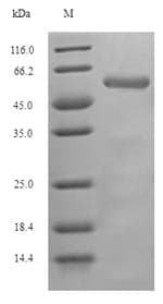 Drosophila melanogaster Pka-C1 Protein (Recombinant 6His-SUMO, N-terminus)
