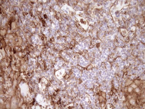 Monoclonal Mouse anti-Human EPLIN Antibody (clone OTI9F3, aa1-275, IHC, WB)