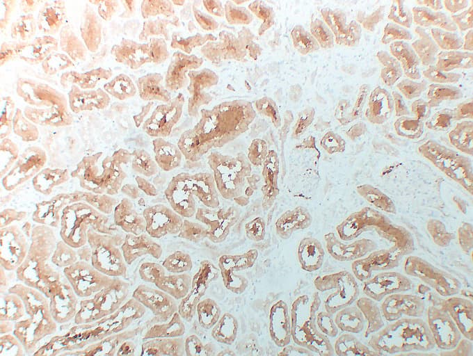 Monoclonal Mouse anti-Human HDAC6 Antibody (clone ABT-HDAC6, IHC)