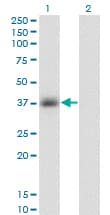GPD1 Antibody (clone 3C10-1C4)