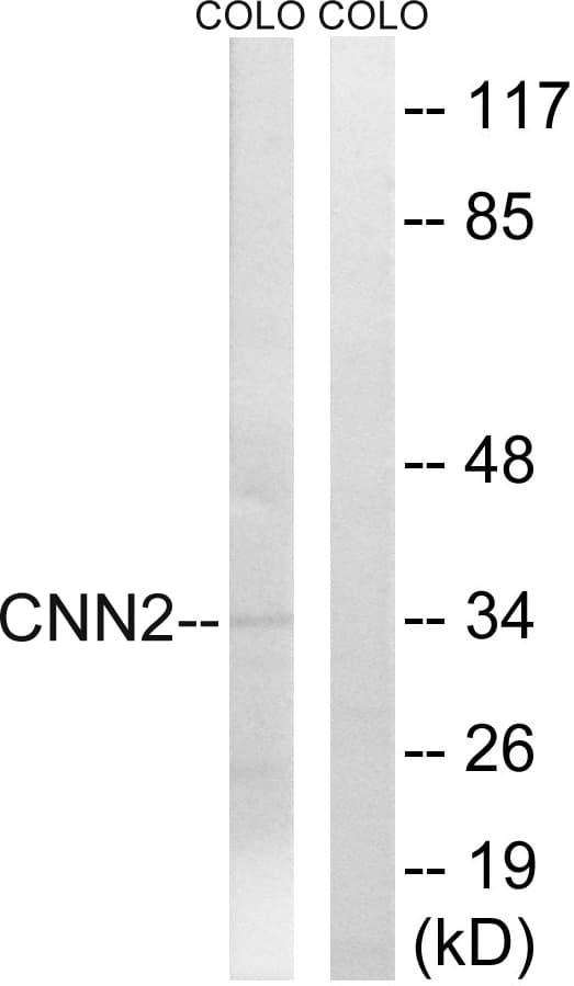 Polyclonal Rabbit anti-Human CNN2 Antibody (aa121-170, IF, WB)