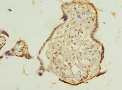 TMEM115 Antibody