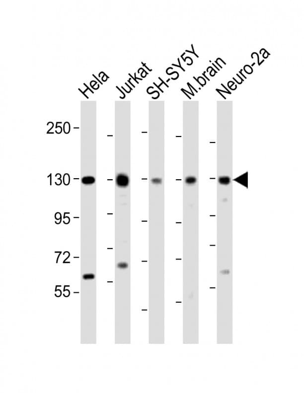 Polyclonal Rabbit anti-Human DBN1 / Drebrin Antibody (Internal, WB)
