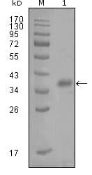 Monoclonal Mouse anti-Human FABP4 / AP2 Antibody (clone 5H11A4E11, WB)