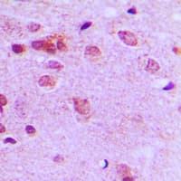 FER Antibody (C-Terminus)
