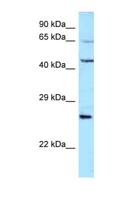 ALS2CR11 Antibody (N-Terminus)