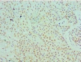 SERPINB5 / Maspin Antibody (aa21-189)