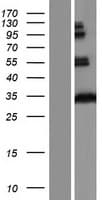 Human HCCS Protein (Over-Expression Lysate Myc-DDK (Flag))