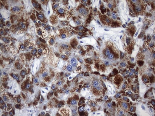 Monoclonal Mouse anti-Human AMACR / P504S Antibody (clone UMAB215, IHC)